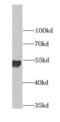 ATP Synthase F1 Subunit Alpha antibody, FNab00702, FineTest, Western Blot image 