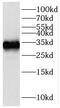 Insulin Like Growth Factor Binding Protein 2 antibody, FNab04176, FineTest, Western Blot image 