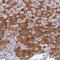 Ribosomal Protein S19 Binding Protein 1 antibody, HPA042874, Atlas Antibodies, Immunohistochemistry paraffin image 