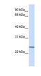 Chromosome 12 Open Reading Frame 49 antibody, NBP1-62508, Novus Biologicals, Western Blot image 