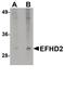 EF-hand domain-containing protein D2 antibody, PA5-20919, Invitrogen Antibodies, Western Blot image 