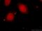 DNA Helicase B antibody, 24700-1-AP, Proteintech Group, Immunofluorescence image 