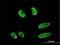 Ring Finger Protein 151 antibody, H00146310-M02, Novus Biologicals, Immunocytochemistry image 