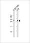 Mitogen-Activated Protein Kinase 1 Interacting Protein 1 Like antibody, 64-084, ProSci, Western Blot image 