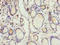 Cellular retinoic acid-binding protein 1 antibody, A55078-100, Epigentek, Immunohistochemistry paraffin image 