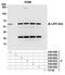 Lamina-associated polypeptide 2, isoform beta antibody, A304-841A, Bethyl Labs, Immunoprecipitation image 