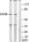 Protein Phosphatase 2 Scaffold Subunit Abeta antibody, TA314375, Origene, Western Blot image 