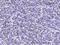 KI-67 antibody, 100130-MM21, Sino Biological, Immunohistochemistry frozen image 