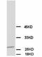 Calbindin 1 antibody, LS-C171055, Lifespan Biosciences, Western Blot image 