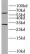 Solute Carrier Family 47 Member 1 antibody, FNab07966, FineTest, Western Blot image 