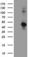 Serpin Family E Member 2 antibody, LS-C787087, Lifespan Biosciences, Western Blot image 