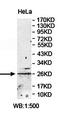 Zinc finger protein 22 antibody, orb78382, Biorbyt, Western Blot image 