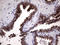 Polypeptide N-Acetylgalactosaminyltransferase 10 antibody, LS-C792064, Lifespan Biosciences, Immunohistochemistry paraffin image 