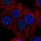 Zinc Finger Protein 778 antibody, HPA052057, Atlas Antibodies, Immunocytochemistry image 