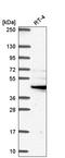 Solute Carrier Family 7 Member 11 antibody, HPA064215, Atlas Antibodies, Western Blot image 
