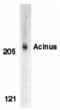 Apoptotic Chromatin Condensation Inducer 1 antibody, MBS150378, MyBioSource, Western Blot image 