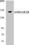 Glutamate Ionotropic Receptor NMDA Type Subunit 2B antibody, EKC1405, Boster Biological Technology, Western Blot image 