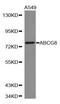 ATP Binding Cassette Subfamily G Member 8 antibody, MBS127805, MyBioSource, Western Blot image 