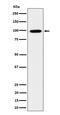 Rho GTPase Activating Protein 26 antibody, M08027, Boster Biological Technology, Western Blot image 
