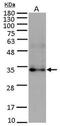 Fibroblast growth factor 10 antibody, GTX101005, GeneTex, Western Blot image 