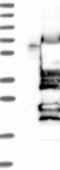 HCLS1 Binding Protein 3 antibody, NBP1-83690, Novus Biologicals, Western Blot image 
