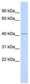 ALX Homeobox 4 antibody, TA331782, Origene, Western Blot image 