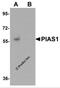 Protein Inhibitor Of Activated STAT 1 antibody, 5741, ProSci, Western Blot image 