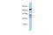 Chromosome 20 Open Reading Frame 141 antibody, 30-828, ProSci, Enzyme Linked Immunosorbent Assay image 