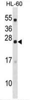 Dynactin Associated Protein antibody, AP50504PU-N, Origene, Western Blot image 