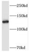 Structural Maintenance Of Chromosomes 5 antibody, FNab08019, FineTest, Western Blot image 