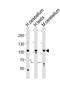 SKI Family Transcriptional Corepressor 2 antibody, PA5-49397, Invitrogen Antibodies, Western Blot image 
