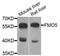 Flavin Containing Dimethylaniline Monoxygenase 5 antibody, A08390, Boster Biological Technology, Western Blot image 