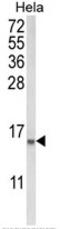 Coactosin Like F-Actin Binding Protein 1 antibody, AP17951PU-N, Origene, Western Blot image 