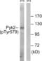 Protein Tyrosine Kinase 2 Beta antibody, abx012658, Abbexa, Western Blot image 