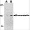 Cerebellin 1 Precursor antibody, 3587, ProSci, Western Blot image 