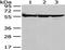 FYN Proto-Oncogene, Src Family Tyrosine Kinase antibody, orb525405, Biorbyt, Western Blot image 