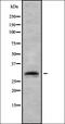 Regulating Synaptic Membrane Exocytosis 4 antibody, orb378402, Biorbyt, Western Blot image 