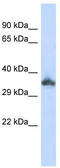 Keratin Associated Protein 24-1 antibody, TA338962, Origene, Western Blot image 