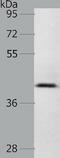 Ras Association Domain Family Member 1 antibody, TA321801, Origene, Western Blot image 