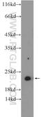 NFKB Inhibitor Interacting Ras Like 2 antibody, 10174-1-AP, Proteintech Group, Western Blot image 
