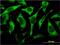 Ribosomal Protein L17 antibody, MA5-19841, Invitrogen Antibodies, Immunofluorescence image 