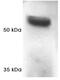 Proteasome 26S Subunit, ATPase 1 antibody, GTX23317, GeneTex, Western Blot image 