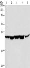 Heterogeneous Nuclear Ribonucleoprotein F antibody, TA351253, Origene, Western Blot image 