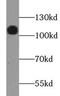 Lysosomal Associated Membrane Protein 2 antibody, FNab09834, FineTest, Western Blot image 