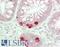 Ribosomal Protein S12 antibody, LS-B14696, Lifespan Biosciences, Immunohistochemistry paraffin image 
