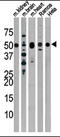 Parkin RBR E3 Ubiquitin Protein Ligase antibody, AP13497PU-N, Origene, Western Blot image 