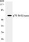 Ribosomal Protein S6 Kinase B1 antibody, EKC1431, Boster Biological Technology, Western Blot image 