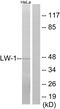 Heat Shock Transcription Factor Family, X-Linked 2 antibody, PA5-38814, Invitrogen Antibodies, Western Blot image 