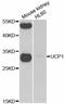 Uncoupling Protein 1 antibody, A5857, ABclonal Technology, Western Blot image 