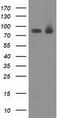 Protein Kinase C Epsilon antibody, TA502439, Origene, Western Blot image 